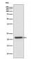 Anti-TIMP2 Rabbit Monoclonal Antibody